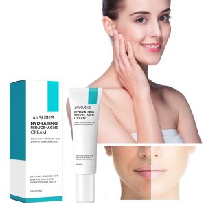 Desalting Pimple Moisturizing Delicate Skin Lightening Cream