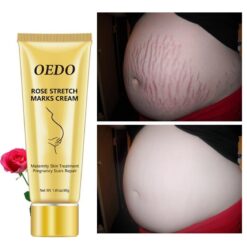 Rose Stretch Mark Removal Cream - Anti-Aging Skin Repair Moisturizer for Pregnancy, Surgery, and Weight Loss