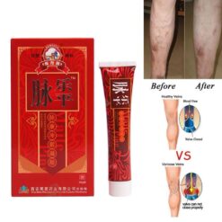 Varicose Vein Treatment Cream - Soothe and Support