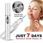 Blue Light Therapy Acne Pen – Wrinkle & Scar Removal Laser Device