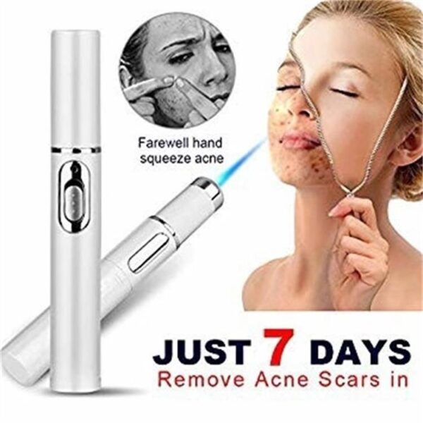 Blue Light Therapy Acne Pen – Wrinkle & Scar Removal Laser Device