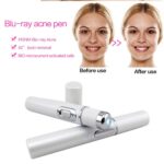 Blue Light Therapy Acne Pen – Wrinkle & Scar Removal Laser Device - Image 9