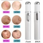 Blue Light Therapy Acne Pen – Wrinkle & Scar Removal Laser Device - Image 3