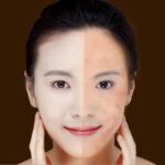 Blue Light Therapy Acne Pen – Wrinkle & Scar Removal Laser Device - Image 8
